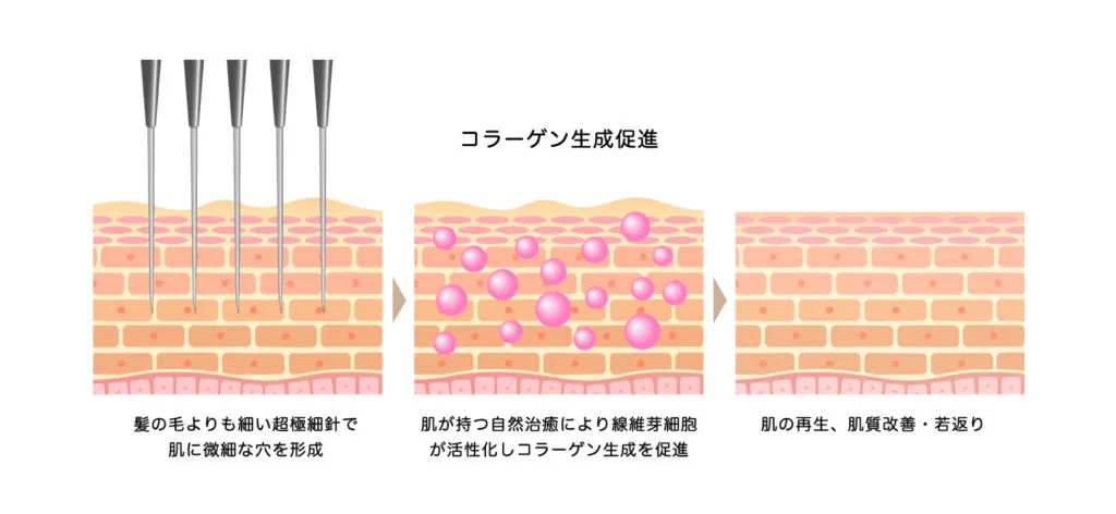 コラーゲン・エラスチンの生成促進