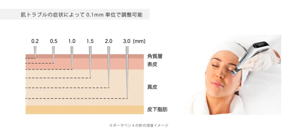 ダーマペン4 深度調整イメージ（0.2mm〜3.0mm）