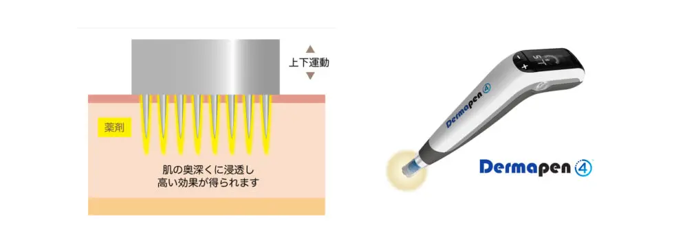美容薬剤との相乗効果