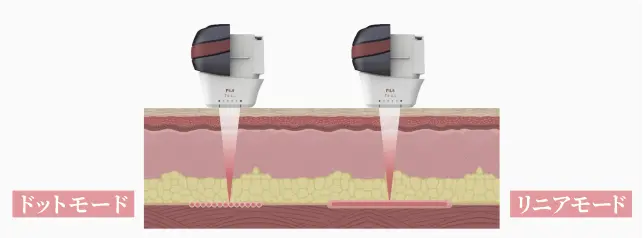 オリジオハイフ