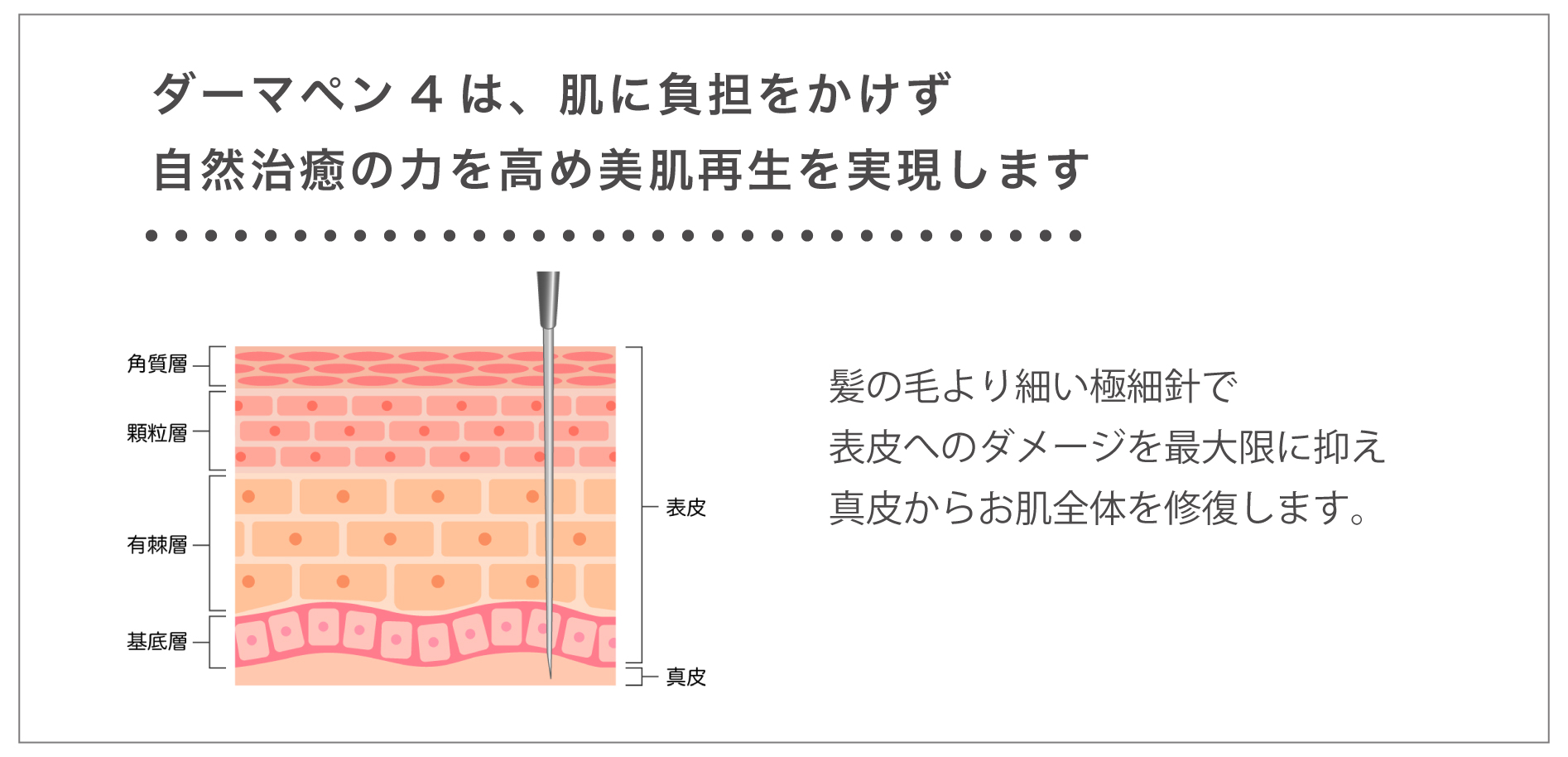 ダーマペン4 渋谷駅前おおしま皮膚科